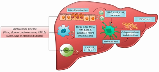 Liver Fibrosis and Inflammation in Chronic Viral Hepatitis {faces}